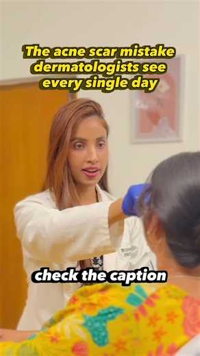 The #1 Acne Scar Mistake Dermatologists See Every Single Day 🚨