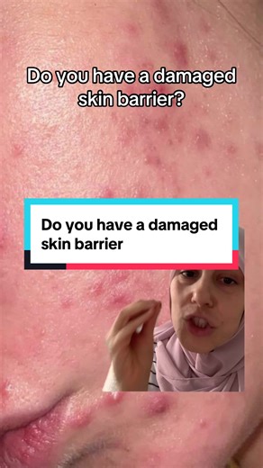 Understanding the Importance of Your Skin Barrier