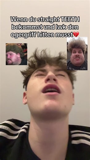 Straight Teeth Transformation Journey