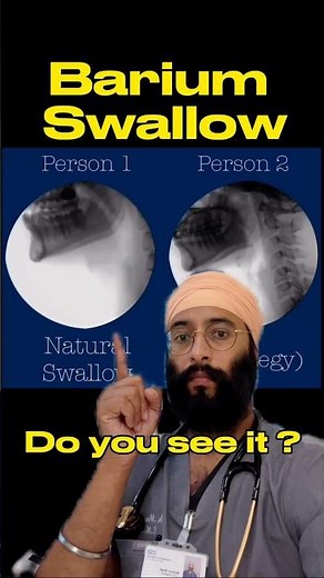 Live Swallowing X-rays | Fluoroscopy