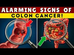 12 DEADLY Signs You're Ignoring Colon Cancer