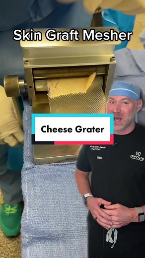 Skin Graft Mesher: How It Works & Benefits