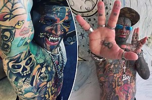 I chopped off my finger — now I’m removing skin to look like an alien