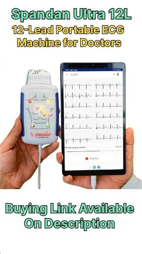 Best Portable ECG Machine for Hospital and Doctors🎰 | #shorts