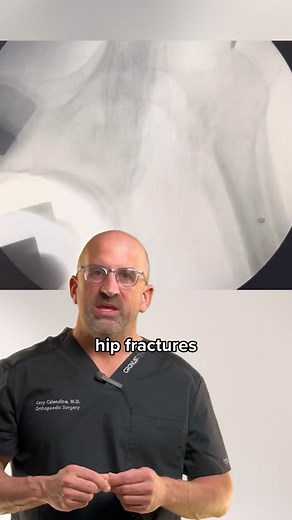 Hip Fracture Surgery and Recovery: What You Need to Know