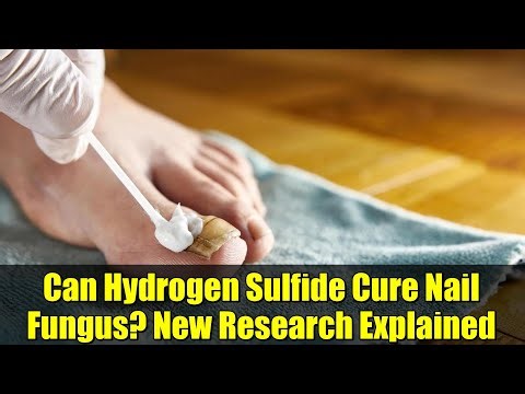 Can Hydrogen Sulfide Cure Nail Fungus? New Research Explained