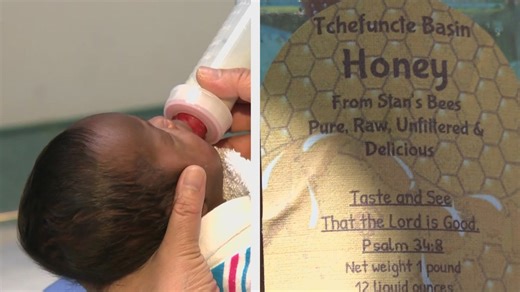 Warning issued after local infants treated for botulism