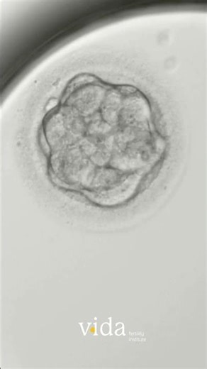 Time-Lapse Technology State-of-the-art incubators | Vida Fertility