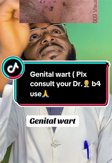 Understanding Genital Warts: Causes and Symptoms