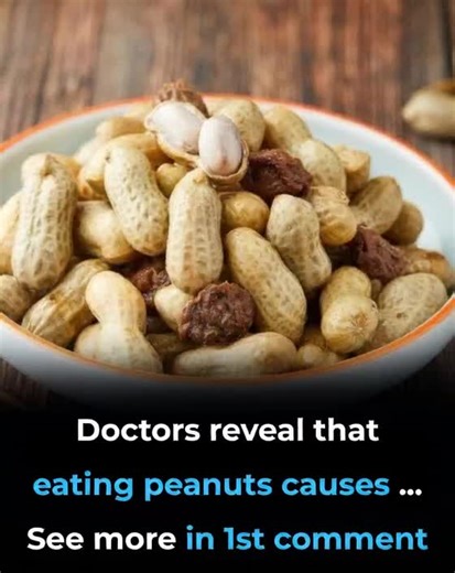 5K views | Doctors Reveal That Eating Peanuts Causes ... See more in 1st comment  | Daily Talks | Facebook
