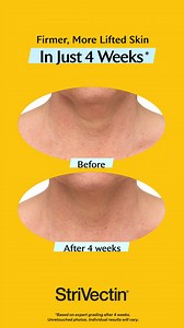 Visibly tighten and smooth horizontal neck lines in just 4 weeks with the upgraded TL Advanced™ Tightening Neck Cream. | StriVectin