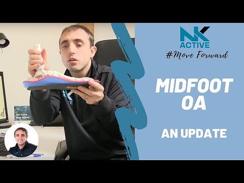 Midfoot Osteoarthritis - An update and how you can treat it