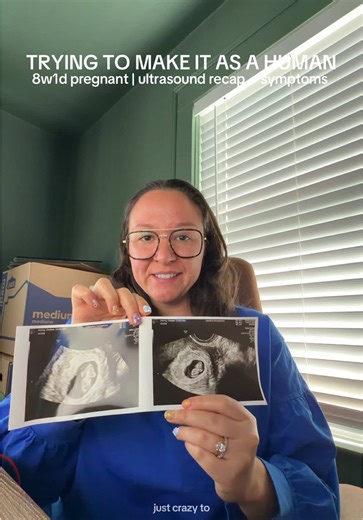 8 Weeks Pregnant: Ultrasound Recap and Symptoms