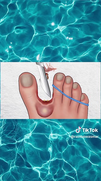 "Dirty feet cleaned, peeled and treated to perfection 🦶🧼 Relaxing ye...