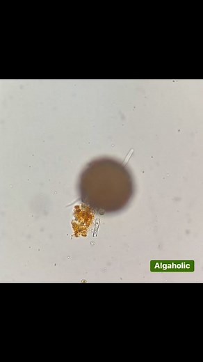 A testate amoeba. From freshwater, Thailand. #testate #testateamoeba #microscope #amoeba | Algaholic