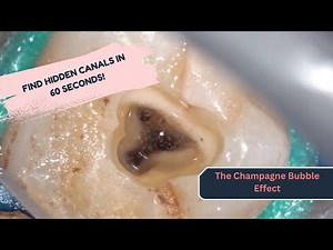 The Champagne Bubble Test – A Fast, Visual Trick for Finding Hidden Canals