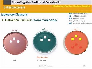 Diagnostic Microbiology: Enterobacterals (Enterobacteriaceae)