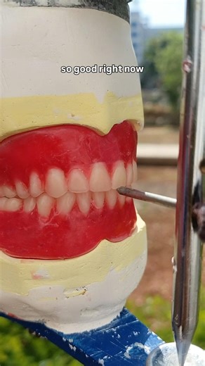 What a tooth setting looked like 🦷 ✨ 🤗 #foryoupage #explore #dentallife #minivlog