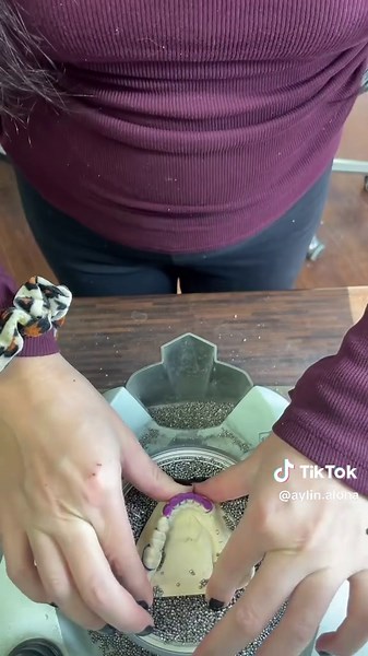 Retainer 🍇 #retainer #teeth #invisalign #diş #dental | retainer