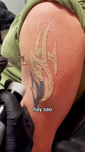 Where does tattoo ink actually go after it's removed? 🤯