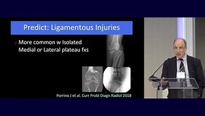 Tibia Plateau Fx's With Meniscal and/or Ligamentous Injuries
