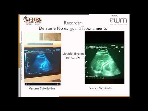 Exploración ecográfica siguiendo protocolo FAST