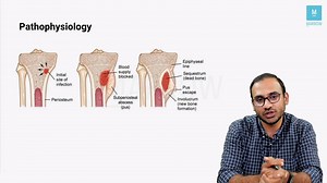 10K views · 269 reactions | Marrow Master Classes: Orthopaedics Sample Video - Bone Infections - Pyogenic (20 mins) | Marrow | Facebook