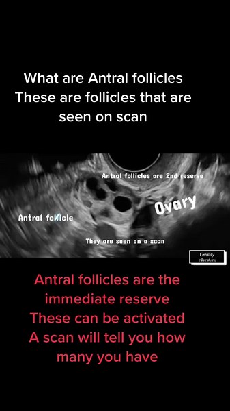 FertilityPlus on TikTok