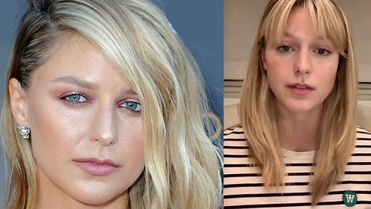 'Supergirl' Star Melissa Benoist Reveals She Is An Abuse Survivor