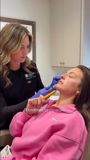 Let’s talk about Sculptra💉#sculptra #injectables #medspa #aesthetics