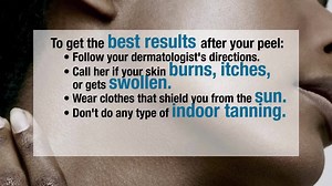 15K views · 67 reactions | They can reduce the appearance of lines and dark pigmentation. But not all are created equal. | WebMD | Facebook