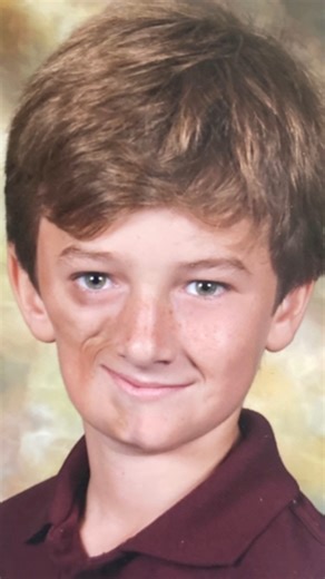 74K views · 801 reactions | We're twins - but only from one side ❤️ #fbreels #borndifferent #twins #twinbrothers #brothers #ParryRombergsyndrome #facialdifference | Born Different | Facebook