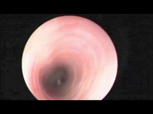 Gyrfalcon Trachea & Syrinx