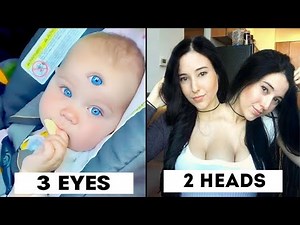 15 Rare & Weird People That Defy All Logic