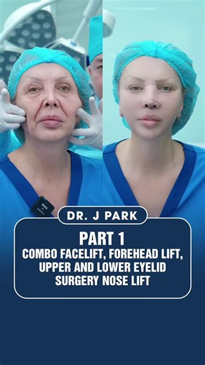 Seamless suturing, minimal scarring — where technique meets natural beauty #DrJ #MinimalScarring #ScarlessFacelift #PrecisionSurgery #NaturalFacelift