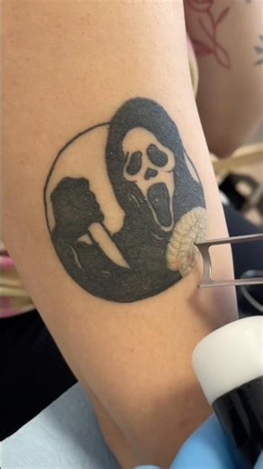 How Does Laser Remove a Tattoo So Fast? 🤯