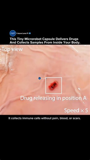 Magnetically Driven Smart Capsules for Targeted Drug Delivery & Sampling #robot #medicine #shorts