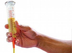 A Dietetic Perspective of Nasogastric Feeding