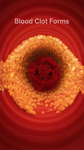 What Happens When an Artery Gets Blocked? | Heart Attack & Stroke Explained in 3D