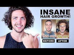 ✅ Awkward Stage Inspiration - INSANE Hair Growth Time Lapses