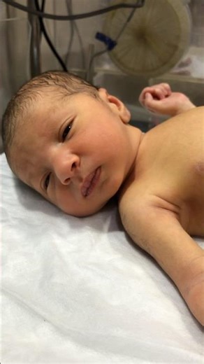 Neonatal Jaundice Baby 🟡 | Yellow Skin in Newborn | NICU Care