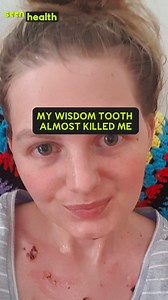 514 reactions · 51 shares | They Wanted To Amputate My Tongue ‘I thought I'd bitten my tongue, but within a few hours my tongue went black and I was in a coma.’ An extremely rare infection caused by a trapped wisdom tooth made Caitlin's body septic. After her near-death experience, she raises awareness about the seriousness of sepsis and how it can happen to anyone. | seen.tv | Facebook