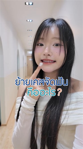 ย้ายเคสจัดฟันคืออะไร ทำไมต้องย้ายเคส คลิปนี้มีคำตอบค่ะ TEETH TALK DENTAL CLINIC จัดโปร 🔥 โปรจัดฟัน ย้ายเคสหรือรอบ 2 จ่ายเพียงเดือนละ 1,500 บาท x12 เดือน = 18,000 1,500 บาท x18 เดือน = 27,000 🎁 ฟรี!! ของแถม 6 รายการ มูลค่ากว่า 5,900.- - ปรึกษาทันตแพทย์ - วิเคราะห์วางแผนรักษา - อุปกรณ์จัดฟัน ทั้งบนและล่าง - ชุดน้ำยาฟอกสีฟันที่บ้าน - ติดหลุด 3 ตัว - จัดต่อจนจบ เมื่อชำระครบตามรอบแล้ว *เงื่อนไขเป็นไปตามที่บริษัทฯ กำหนด . เงื่อนไขการชำระเงินอื่นๆ True&Dtac รับส่วนลด 5% ขูดหินปูน อุดฟัน ถอนฟัน ถึง 31