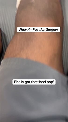 Achieving the Heel Pop in Isometric Knee Extensions