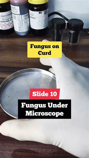 Fungal Colony under Microscope #microscopy