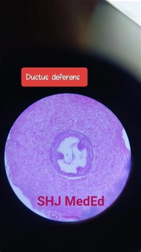 Fallopian tube, Vas deferens,Epidydymis,Uterus,Appendix ,kidney,large intestine, Microscopic view.