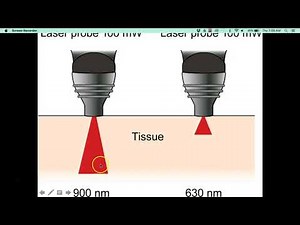 Electromagnetic Radiation: Lasers and Low Level Light Therapy