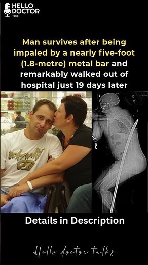 Man survives after being impaled by a nearly five-foot (1.8-metre) metal bar.