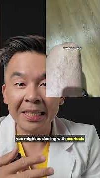 Psoriasis or just dry skin?