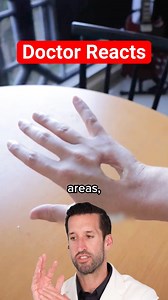 Doctor Reacts to Hand “Hole” 😳 | Doctor ER